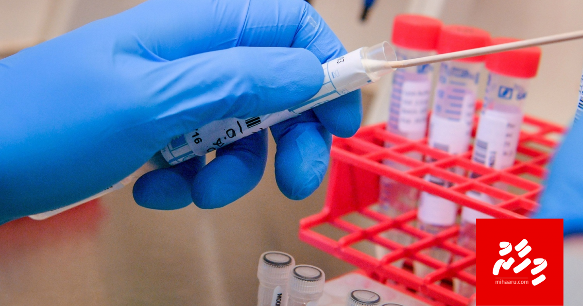 1 mas nufurey kujjaku covid-19 ah positive vejje