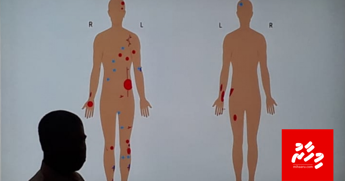 Nasheed ge fuppaa meyah vaiy ethikolhu hithah nuvanee kashigandeggai jehumun: ADK