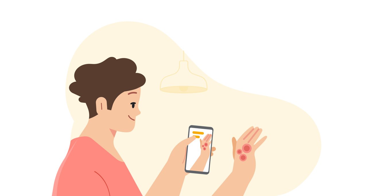 Using AI to help find answers to common skin conditions