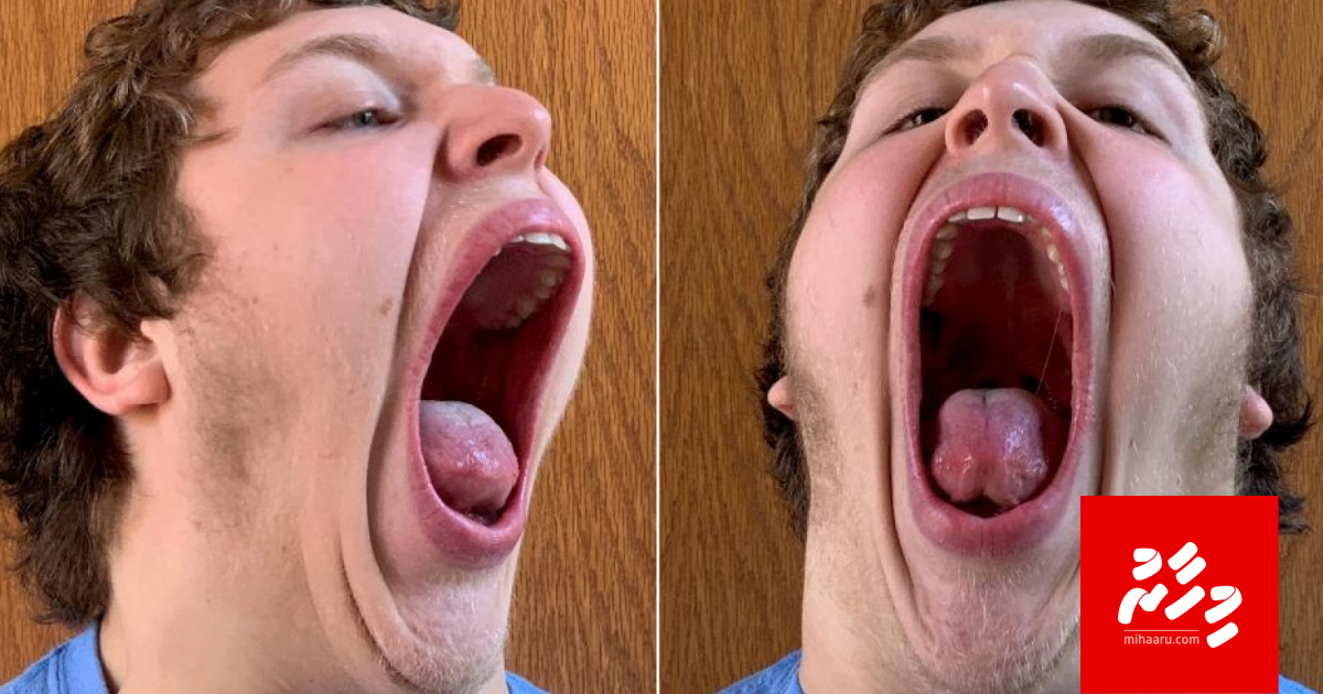 Miee enme bodu anga!