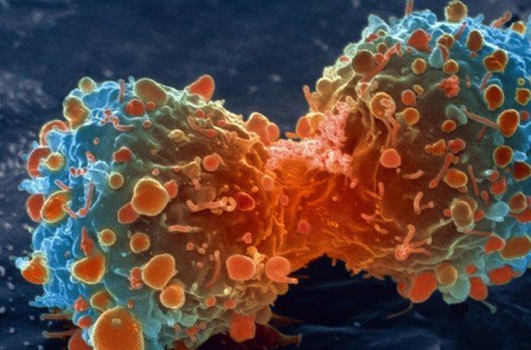 އަންނަ އަހަރު ކެންސަރަށް ފަރުވާ ހޯދިދާނެ ކަމަށް ބުނެފި