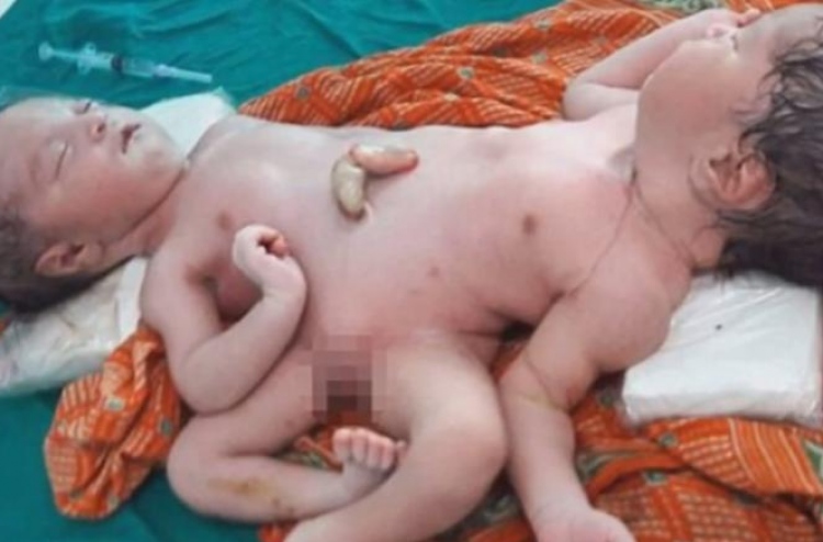 "ހުރިހާ ގުނަވަނެއް" ގުޅިފައިވާ ދެބެން އުފަންވެއްޖެ