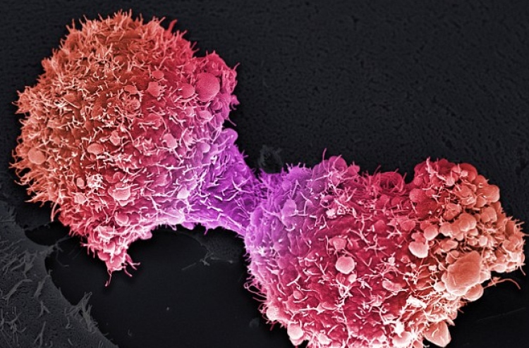 އެންމެ ރާ ތައްޓަކުން ވެސް ކެންސަރަށް ހުށަހެޅޭ