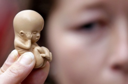 އެބޯޝަން ހެދުން: ތުއްތުކުދިންނަށް ދެވޭ އަނިޔާއެއް