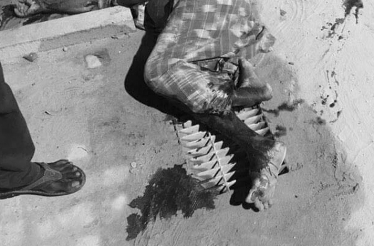 ސައިކަލަކުން ޖެހި ކުޅުދުއްފުށީ މީހެއްގެ ހާލު ސީރިއަސް