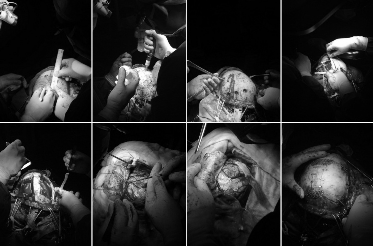 އޭޑީކޭގައި ސިކުނޑީގެ ބޮޑު އޮޕަރޭޝަނެއް ކޮށްފި