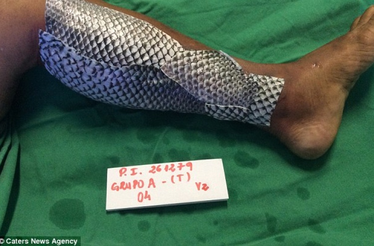 ފިހުނު ތަނަކަށް މަހެއްގެ ހަމުން ފަރުވާ ދީފި