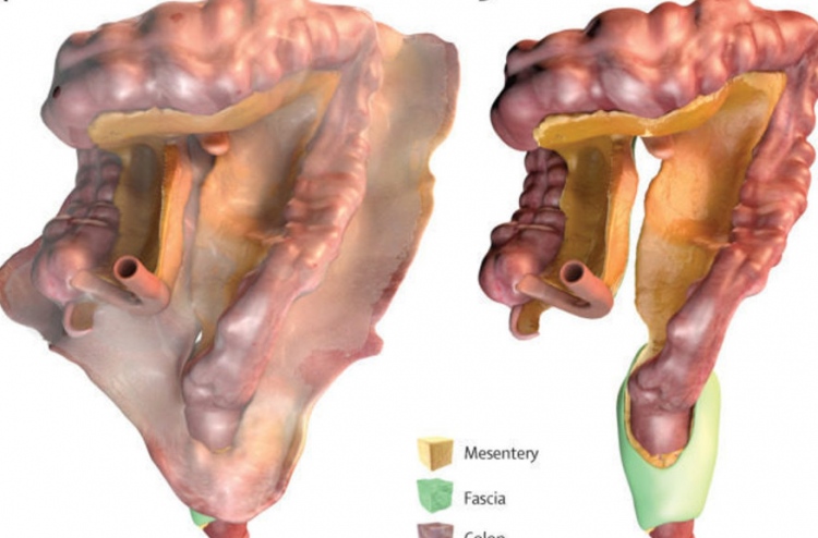 އިންސާނާގެ އެތެރެހަށިން އާ ގުނަވަނެއް ފެނިއްޖެ