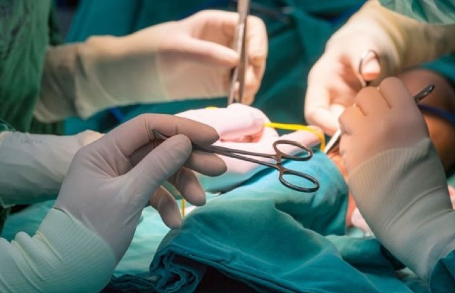 އޮޕަރޭޝަނެއް ކުރަނީ: ސިޒޭރިއަންއަކީ ދިމާވެދާނެ މައްސަލައަކުން ބޮޑު ގެއްލުމެއް ލިބިދާނެ ފަދަ އޮޕަރޭޝަނެއް.