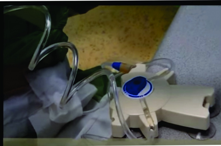 އިންޑިއާ މީހަކު ގޭގައި އަމިއްލައަށް ޑަޔަލިސިސް ހަދަނީ