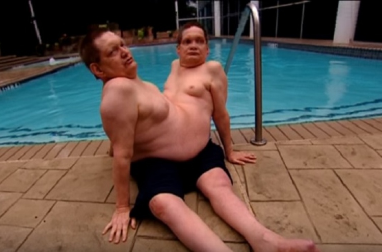 ހަށިގަނޑުން ގުޅިފައިވާ އެންމެ ދުވަސްވީ ދެބެން