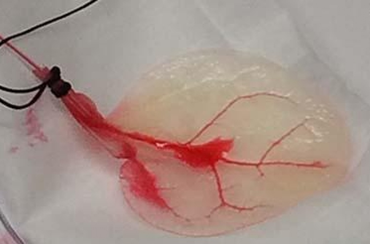 ސްޕިނެޗް ފަތް އިންސާނާގެ ހިތުގެ ޓިޝޫ އަކަށް