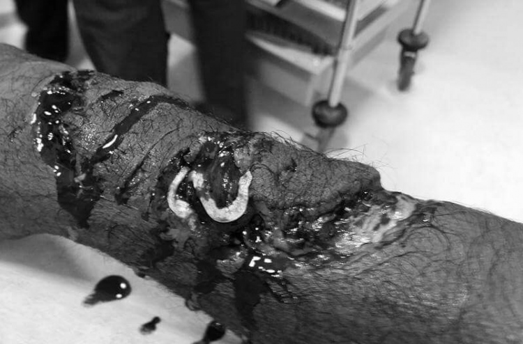 މިޔަރުގެ ހަމަލައެއްގައި ދިވެއްސަކު ޒަޚަމްވެއްޖެ