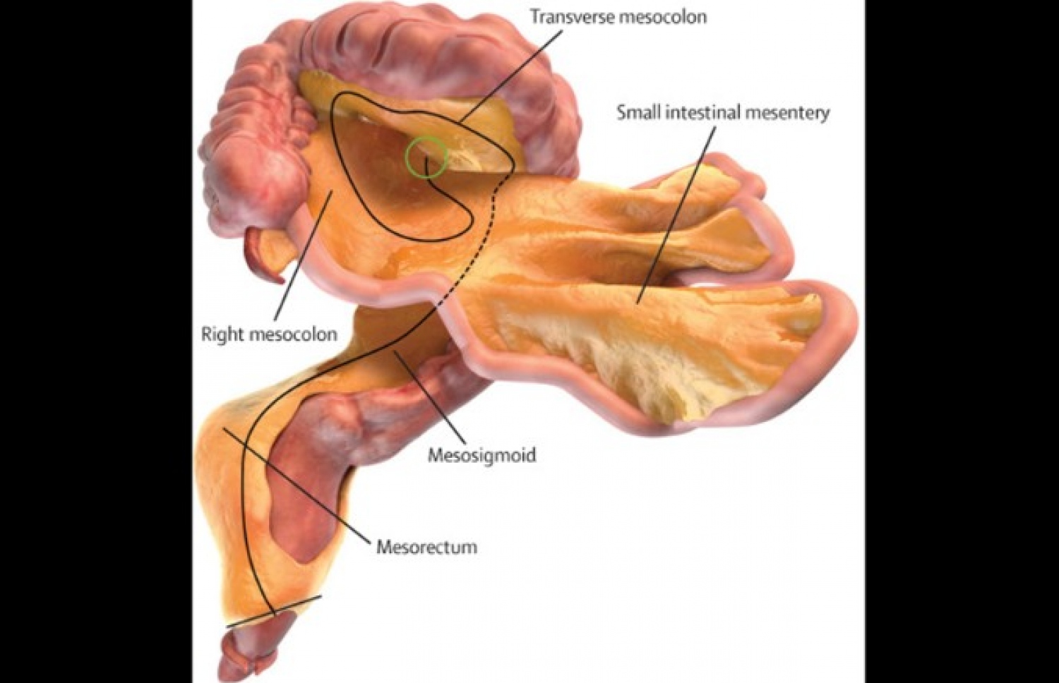 މިސެންޓްރީ