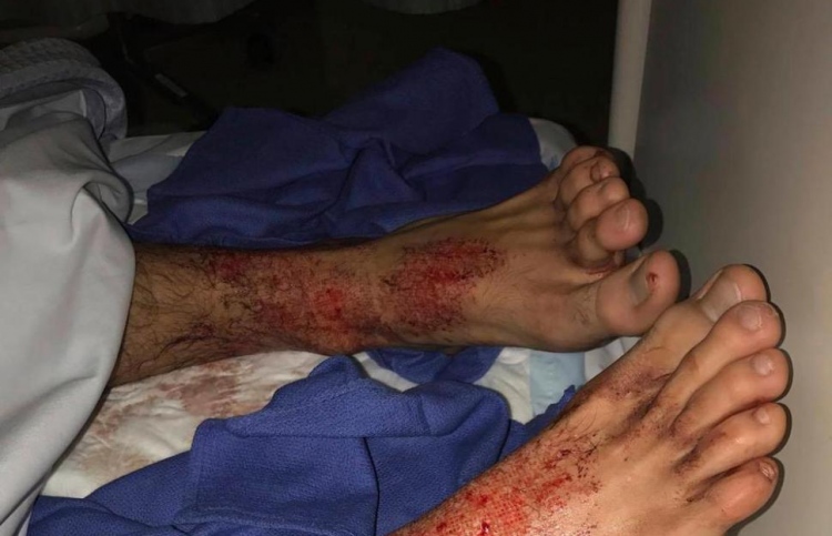 މޫދަށް އެރުމުން ފައިން އަންނަން ފެށީ ލޭ