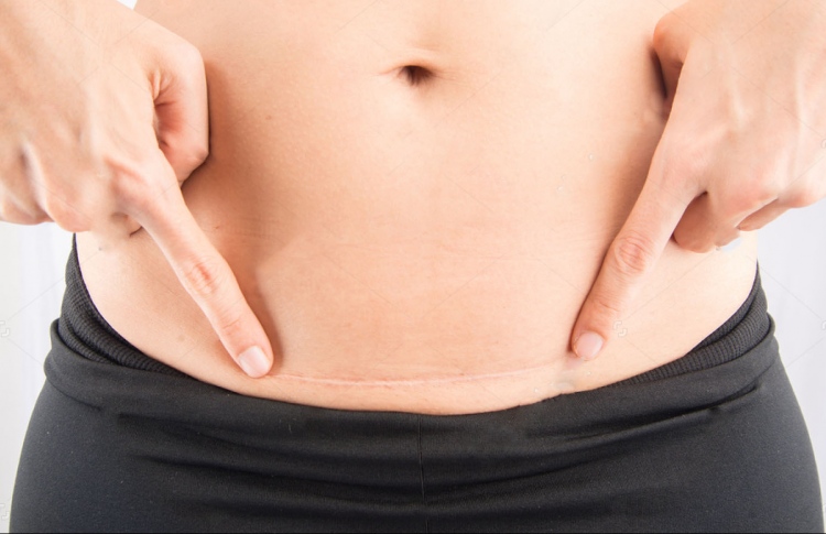 ސިޒޭރިއަން ހަދަން ފަޅާލި ތަނަށް ތަދުވޭތަ؟