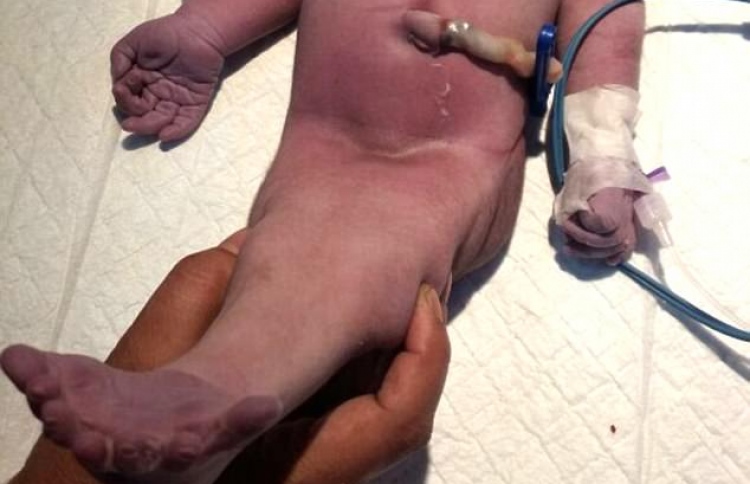 "މާމެއިޑް" ކުއްޖާ ހަތަރު ގަޑިިއިރު ތެރޭ މަރުވެއްޖެ