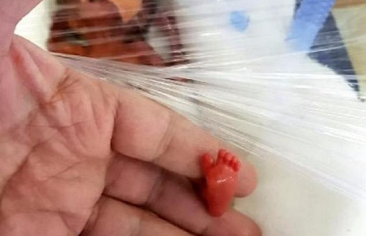 400 ގްރާމް ހަމަނުވާ ކުއްޖަކު ސަލާމަތްކުރެވިއްޖެ