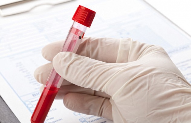 ލޭގެ ޓެސްޓަކުން ކެންސަރު ދެނެގަނެވިދާނެ ކަމުގެ އުއްމީދު