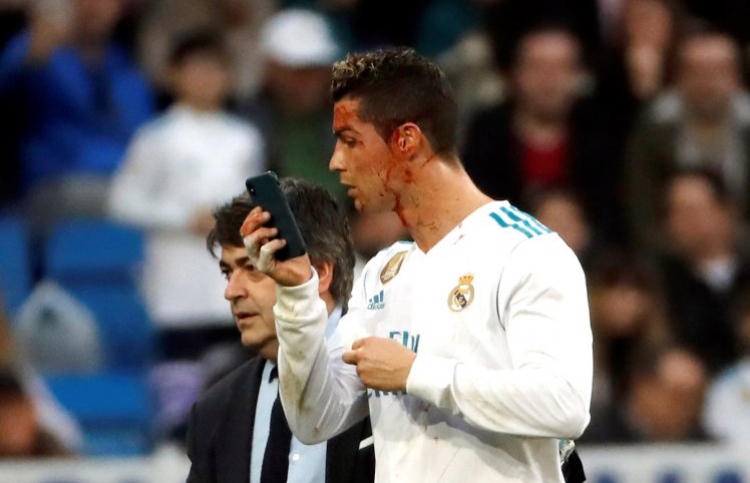 ރެއާލް މޮޅުވިއިރު ރޮނާލްޑޯ ސަމާލުކަން ހޯދައިފި