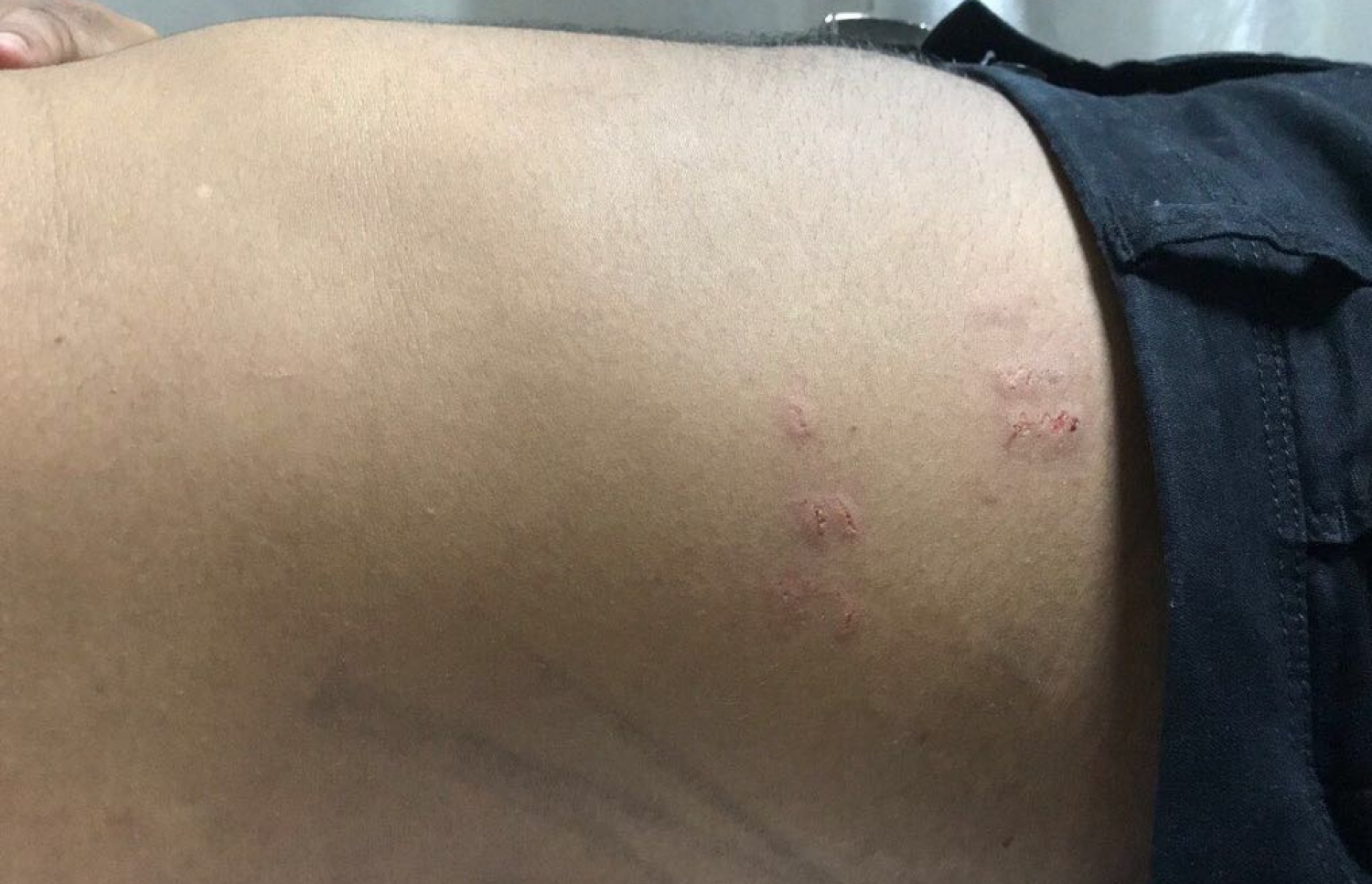 ހުސައިންގެ ހަށިގަނޑުގައި ޒަހަމްތައް، އޭނާ ބުނީ ފުލުހުން އަނިޔާ ކުރީ ކަމަށް--