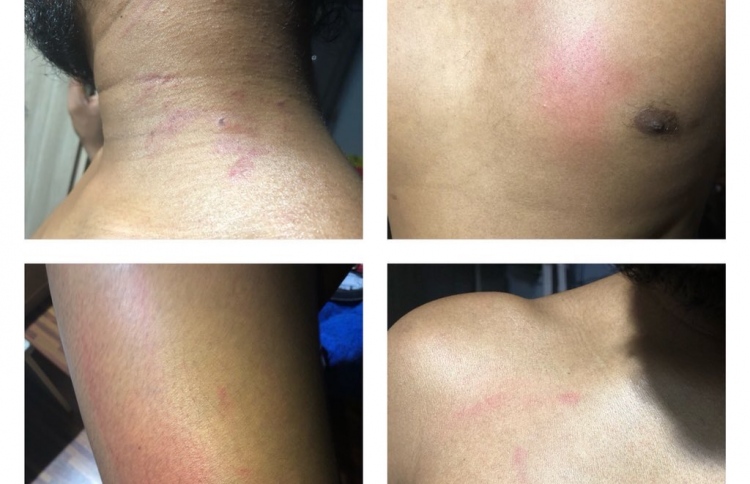 ފުލުސް ވެހިކަލް ތެރޭގައި އަނިޔާކުރި މައްސަލަ ބަލަނީ