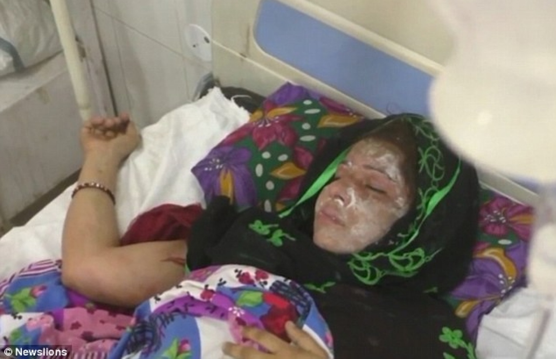 އަންހެން ކުއްޖަކު ވިހެއުމުން މޫނަށް އެސިޑް ޖަހައިފި