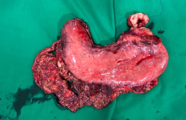 ބޮޑު އޮޕަރޭޝަނަށް ފަހު ޑރ. ޝިފާނަށް ތައުރީފް