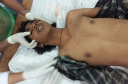 One of the young men injured in the gang fight in Hithadhoo on Saturday night being treated at the Hithadhoo Regional Hospital.