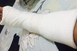 Dhimya's leg after injury. PHOTO:Facebook