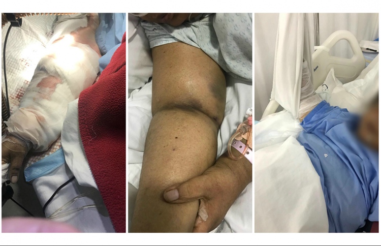 އޭޑީކޭގެ އިހުމާލުން މީހަކު މަރުވި މައްސަލައެއް ބަލަނީ