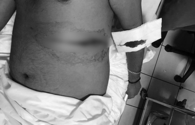 ރޭ ވެސް މާލޭގައި މާރާމާރީ ހިންގައި މީހަކު ޒަޚަމްކޮށްލި