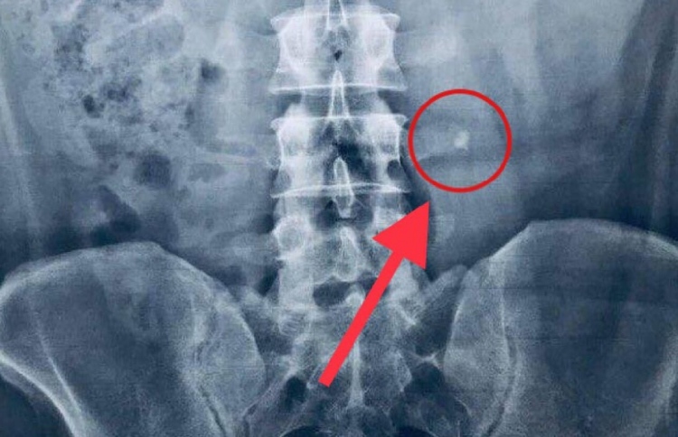 އަދީބުގެ ބަޔާނެއް އެޗްއާރްސީއެމުން ނަގައިފި