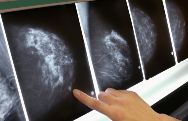 މެމޮގްރަފީ ހަދާނެތޯ ނިންމާއިރު ބަލިމީހާ އެދޭގޮތް ބަލަނީ