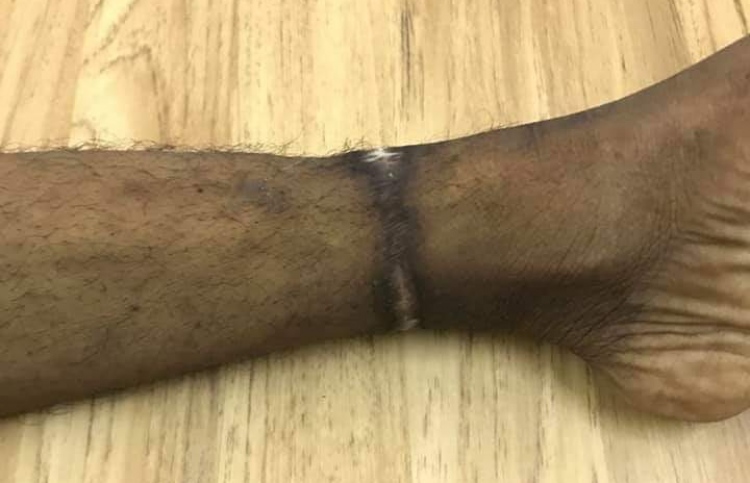 މަރުވިމީހާ ފައިގައި ހުރީ އާއިލާއިން ޖެހި ޗޭނު ނިޝާން