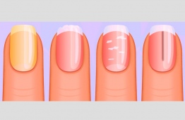 ނިޔަފަތިން ސިއްހީ ބައެއް މައްސަލަތައް ބުނެދޭ