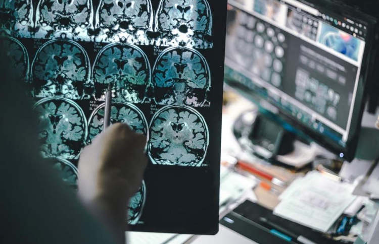 ހަނދާންނެތޭ ބަލީގެ އާ ވައްތަރެއް ހޯދިއްޖެ