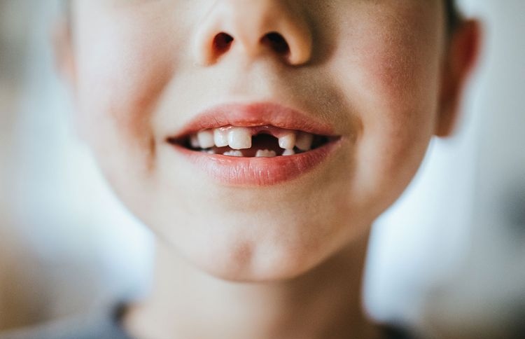 7 އަހަރުގެ ކުއްޖެއްގެ އަނގައިން 526 ދަތް ނަގައިފި