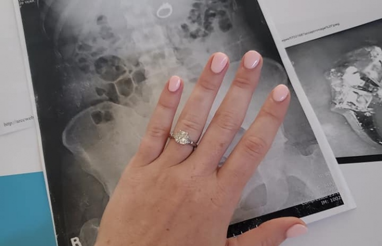 ހުވަފެނުގައި ދިރުވައިލި އަނގޮޓި އޮތީ ބަނޑުގައި