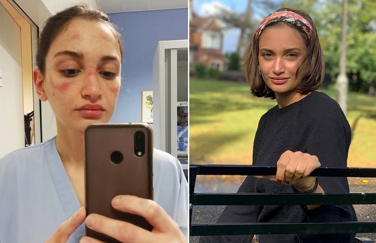 ނަރުހުން: އަސްލު ހީރޯއިންގެ މޫނު