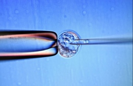 Embryonic stem cells are harvested from fertilised eggs and using them in research has raised ethical issues because embryos are subsequently destroyed. PHOTO: ANNE-CHRISTINE POUJOULAT / AFP