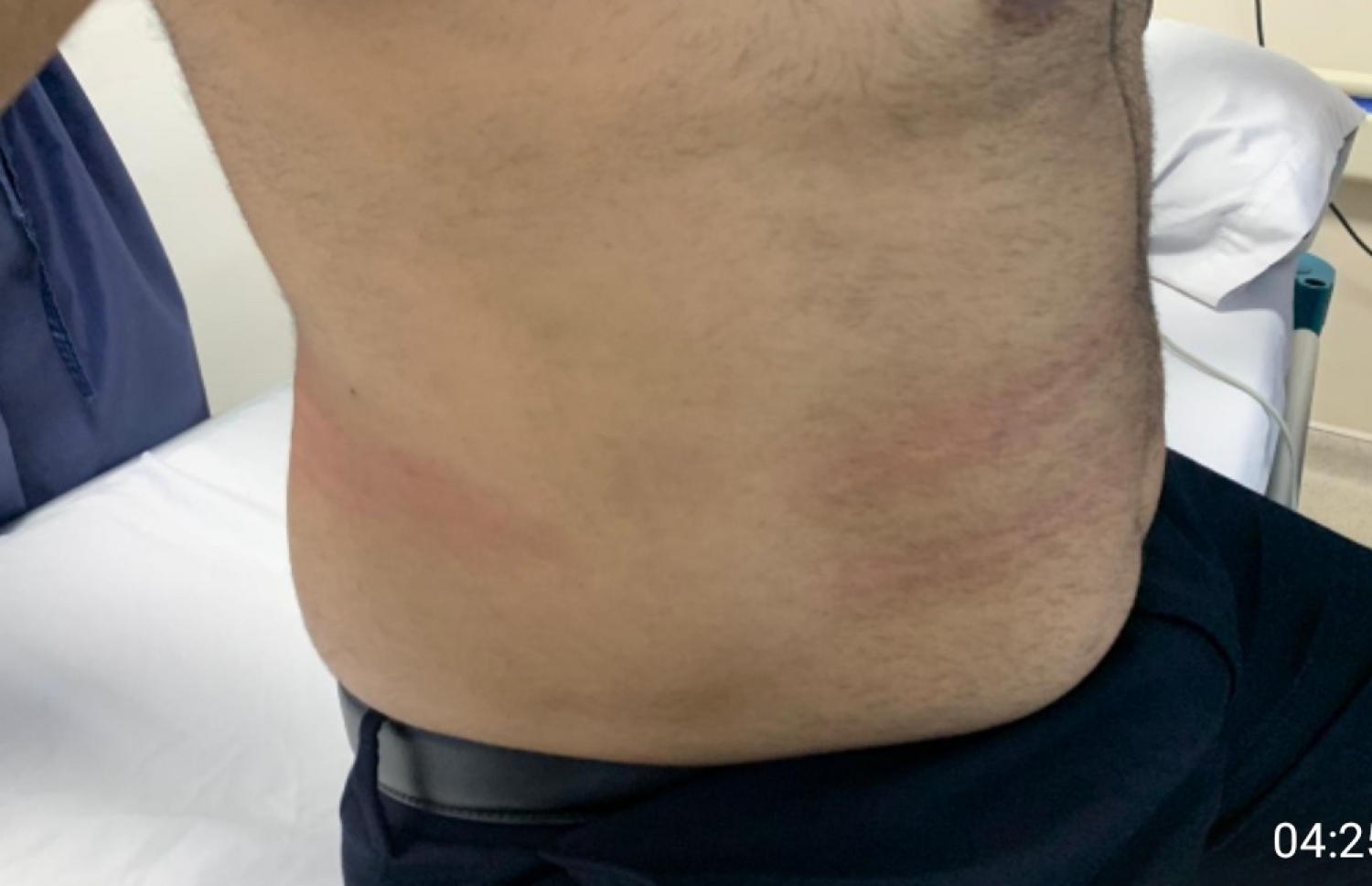 ނައިފަރު ދާއިރާގެ މެމްބަރު ޝިޔާމް މިރޭ މަޖިލީހުން ނެރުމުގެ ތެރޭގައި ހިނގި ހަމަނުޖެހުންތަކުގައި ހަށިގަނޑުގެ ބައެއް ތަންތަން ނޫފައިގެންފައި.