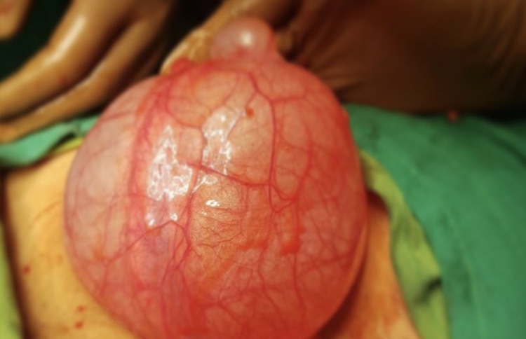 ކުޅުދުއްފުށީގައި މީހެއްގެ އޯވަރީން ބޮޑު ސިސްޓެއް!