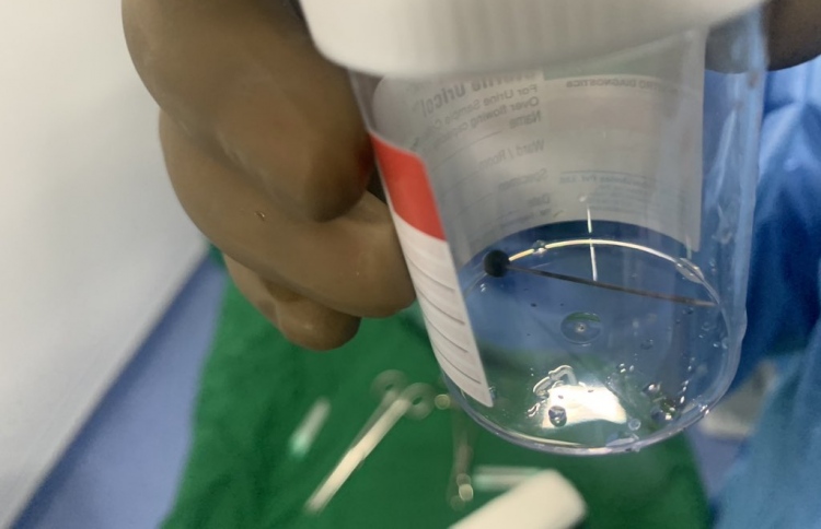 11 އަހަރުގެ ކުއްޖެއްގެ ފުއްޕާމެއިން ޕިނެއް ނަގައިފި