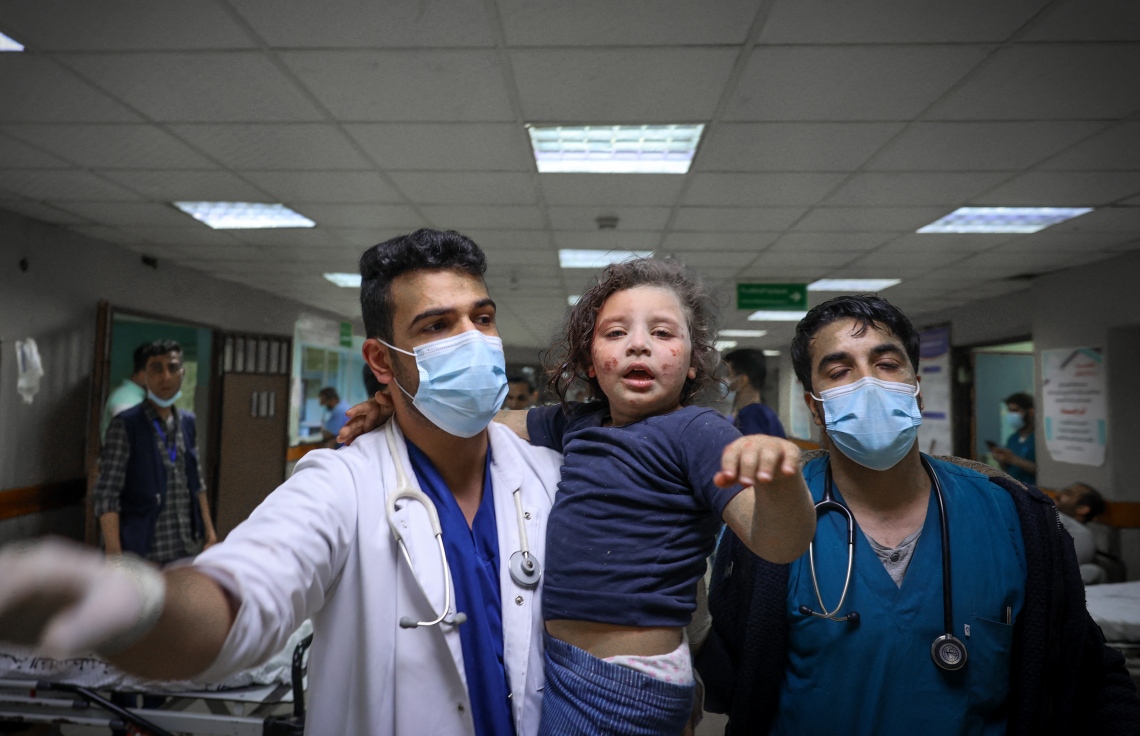 ފަލަސްތީން: ގާޒާ: މޭ 16، 2021: އިޒްރޭލުން ގާޒާއަށް ދެމުންދާ ބޮމުގެ ހަމަލާގައި ވަރަށް ބޮޑަށް ޒަހަމްވެފައިވާ ކުޑަކުއްޖަކަށް ފަރުވާ ދިނުމަށް އަލް-ޝިފާ ހޮސްޕިޓަލުގެ ޑޮކްޓަރުން ހަރަކާތްތެރިވަނީ.-- ފޮޓޯ: އޭއެފްޕީ