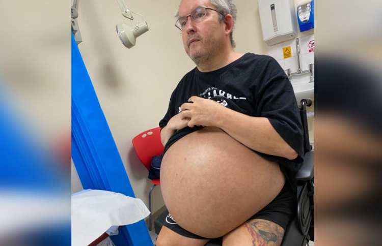 ޔޫކޭ މީހެއްގެ ކިޑްނީ އާދަޔާ ހިލާފަށް ބޮޑުވެ ނަގަނީ