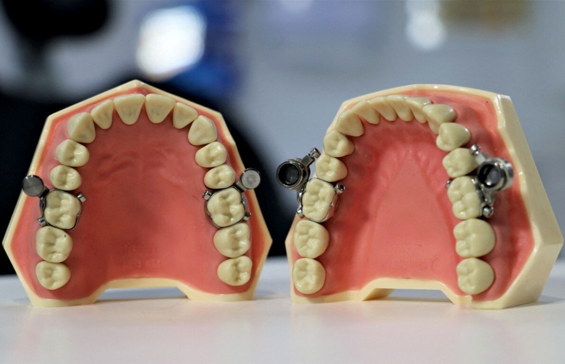 ކާން އުނދަގޫވާ ގޮތަށް ދަތުގައި ހަރުކުރާ ޑިވައިސްއެއް