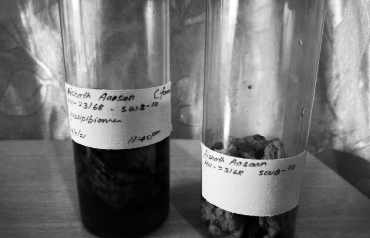 ސިޒޭރިއަން ހެދި މީހެއްގެ ބަނޑުގައި ފޮތިގަނޑެއް!