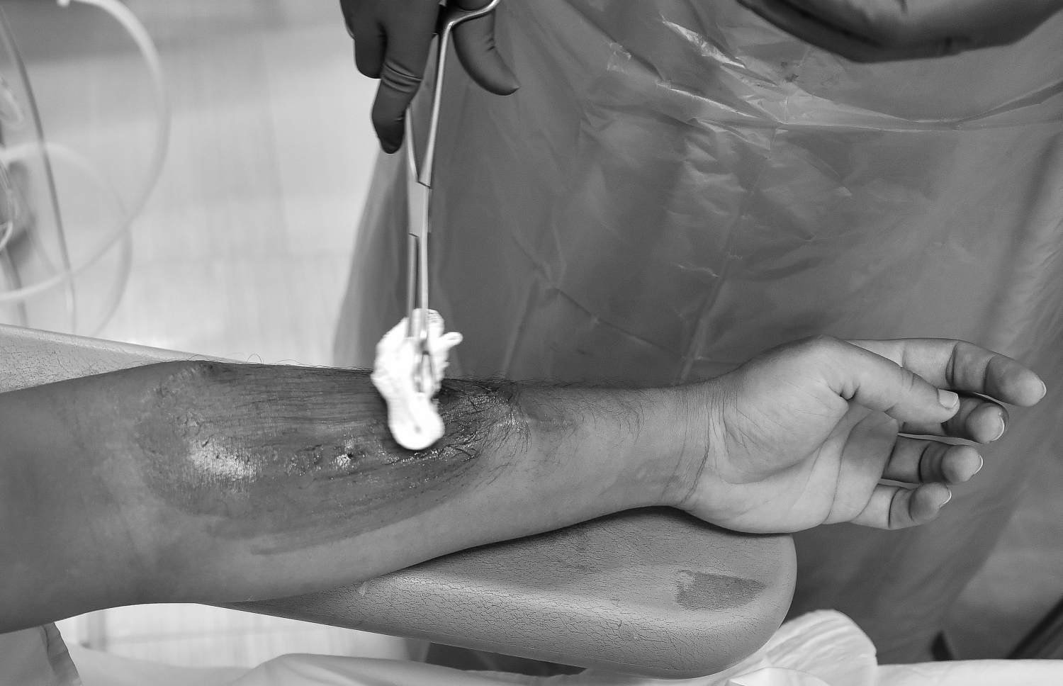 ޑައިލިސިސް ހެދުމަށް މީހަކު އަތަށް ހޮޅި ގުޅުމުގެ ކުރިން ބޭހެއް އުނގުޅަނީ.-- ފޮޓޯ: ނިޝާން އަލީ/ މިހާރު