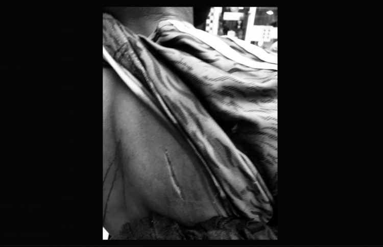 ގެޔަކުން ވެއްޓުނު ކުޑަދޮރަކުން ޖެހި ބޮޑު ޒަހަމެއް